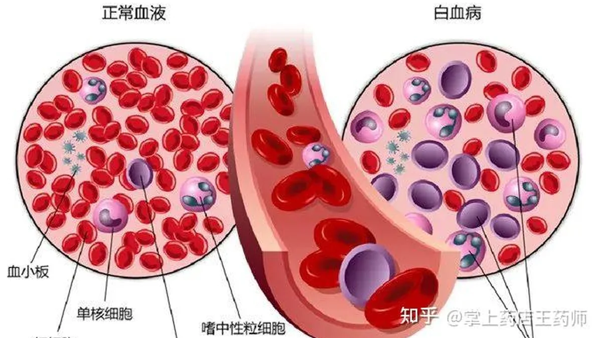 患者家属在医生办公室咨询吉瑞替尼用药前基因检测的必要性